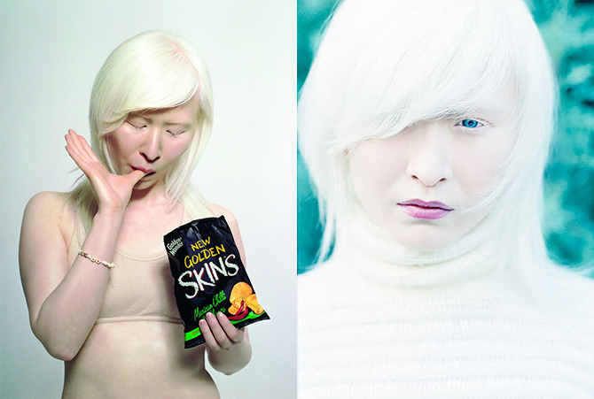 Albino Models_2_4
