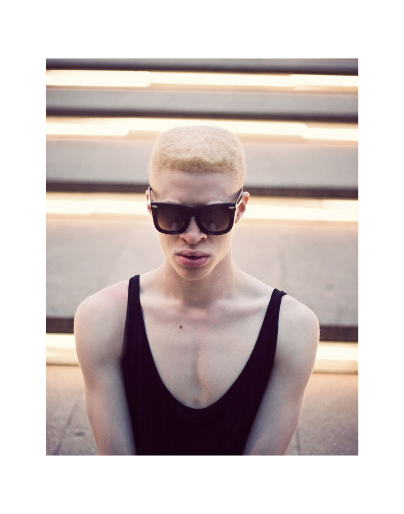 Albino Models_3