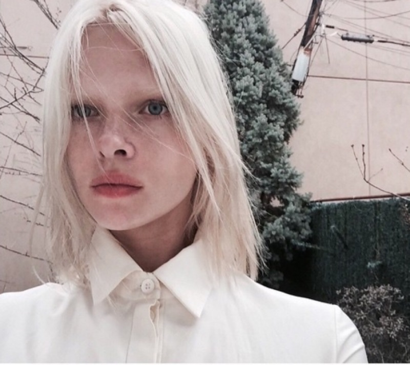 Albino Beauty: Celebrating Diversity In Fashion And Hairstyles