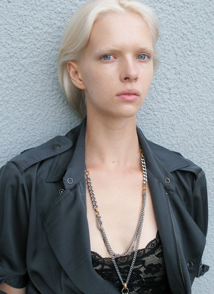 Albino Models_4_1