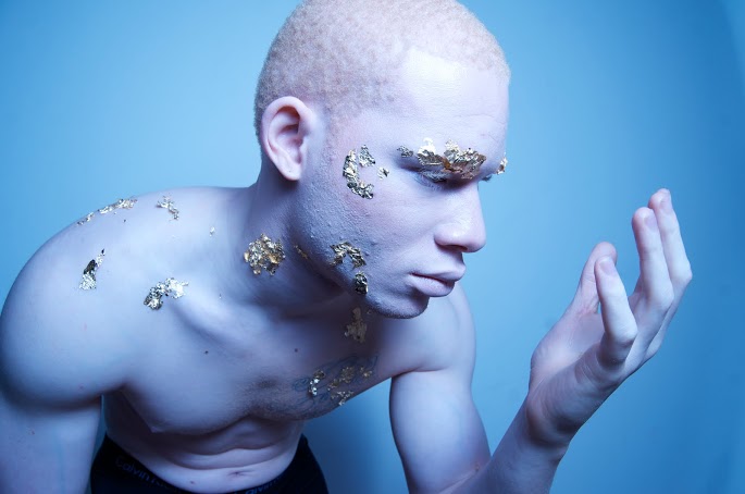 Albino Models_7