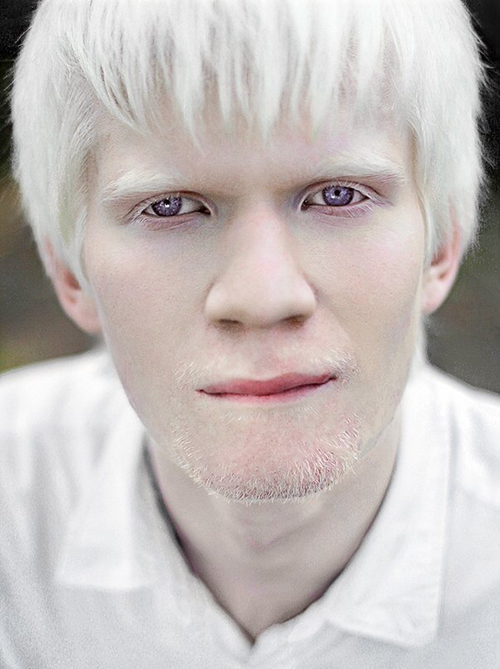  Different Beauty Albino Models Who Are Changing The 