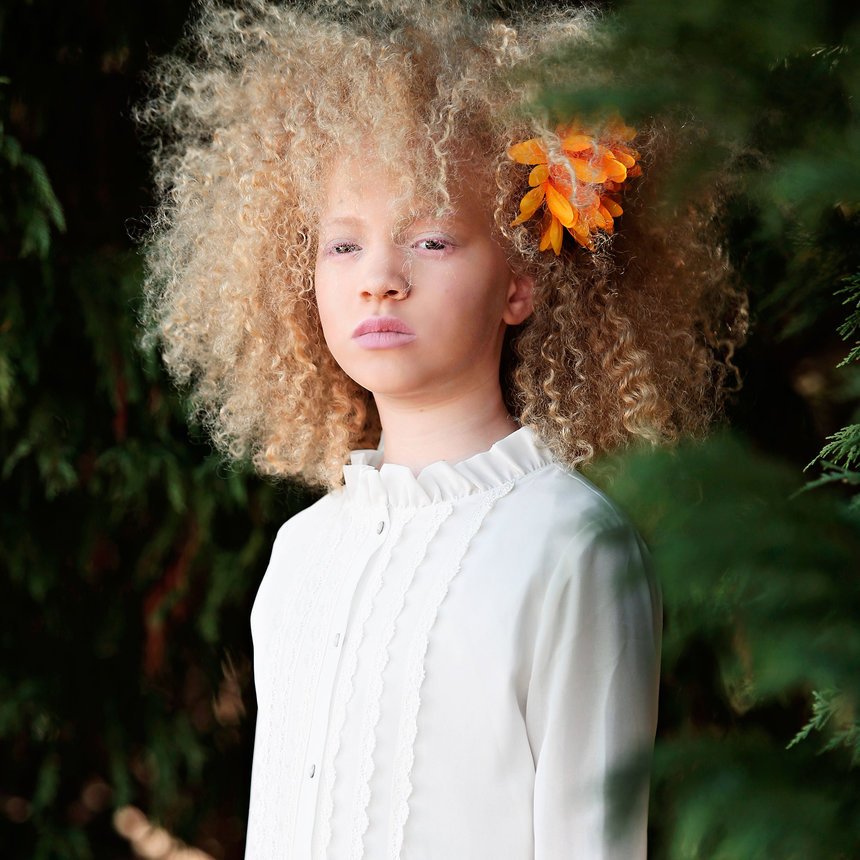 Albino Models_9_3