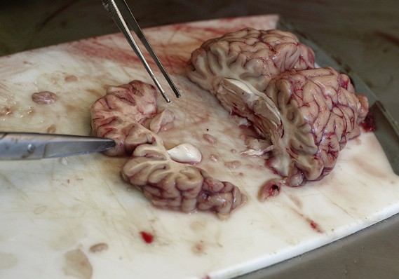 the oddest items people tried to smug_420 pounds of cow brains