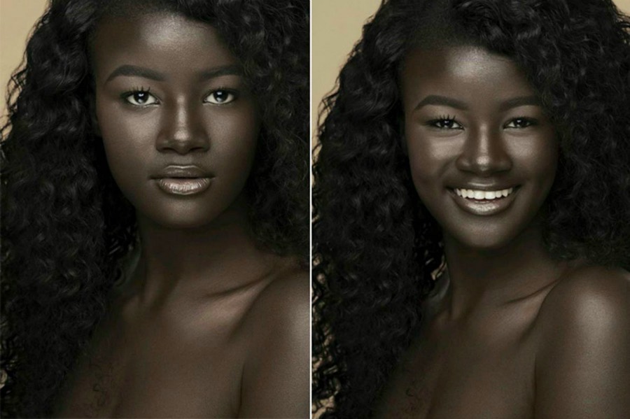 9 people with unique skin_Khoudia Diop